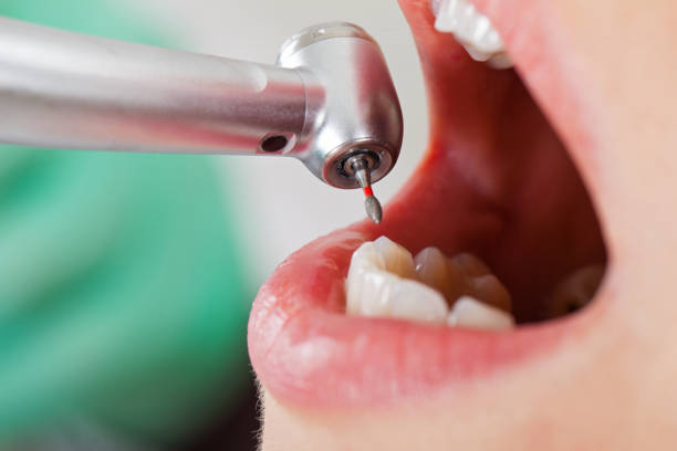 Best Urgent Dental Care in Lexico, CA